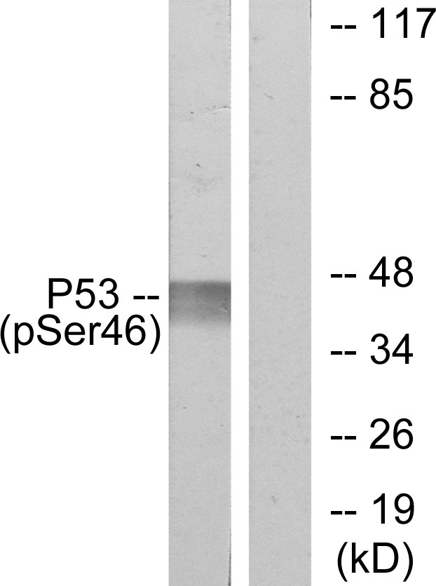 TP53 / p53 Antibody - Western blot analysis of lysates from 293 cells treated with UV, using p53 (Phospho-Ser46) Antibody. The lane on the right is blocked with the phospho peptide.