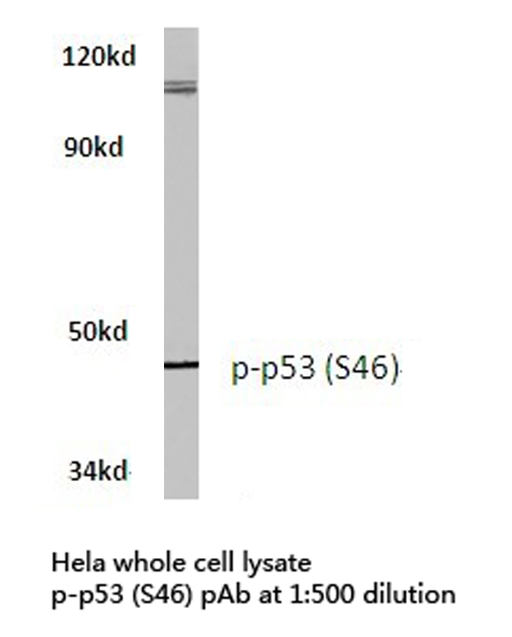 TP53 / p53 Antibody - Western blot of p-p53 (S46) pAb in extracts from HeLa cells.