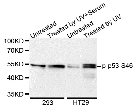 TP53 / p53 Antibody - Western blot analysis of extracts of various cell lines.