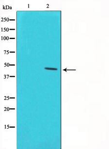 TP53 / p53 Antibody - Western blot analysis of p53 phosphorylation expression in UV treated 293 whole cells lysates. The lane on the left is treated with the antigen-specific peptide.