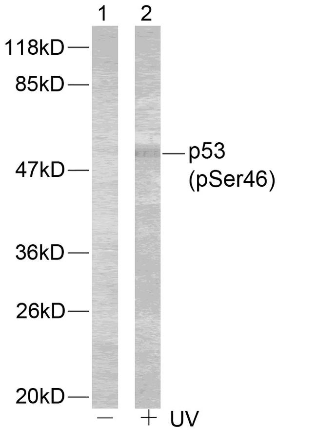 TP53 / p53 Antibody - Western blot analysis of extracts using p53 (Phospho-Ser46) Antibody.Line1: The extracts from 293 cells untreated; Line2: The extracts from 293 cells treated with UV.