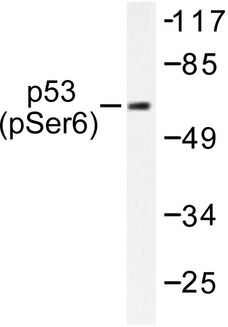TP53 / p53 Antibody - Western blot of p-p53 (S6) pAb in extracts from MDA-MB-435 cells treated with UV.