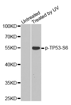 TP53 / p53 Antibody - Western blot analysis of extracts from Hela cells.