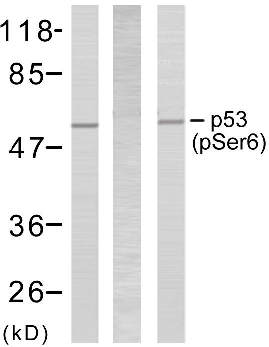 TP53 / p53 Antibody - Western blot analysis using p53 (phospho-Ser6) antibody.