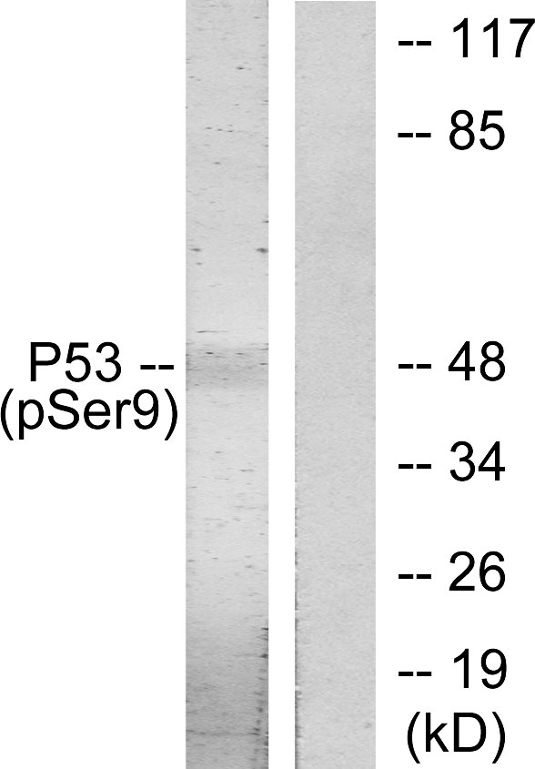 TP53 / p53 Antibody - Western blot analysis of lysates from LOVO cells, using p53 (Phospho-Ser9) Antibody. The lane on the right is blocked with the phospho peptide.