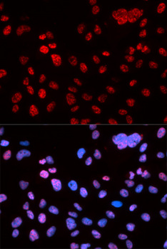TP53 / p53 Antibody - Immunofluorescence analysis of U2OS cells.