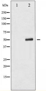TP53 / p53 Antibody - Western blot of p53 phosphorylation expression in LOVO whole cell lysates,The lane on the left is treated with the antigen-specific peptide.
