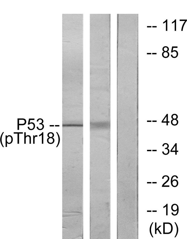 TP53 / p53 Antibody - Western blot analysis of lysates from Ovary cancer and K562 cells, using p53 (Phospho-Thr18) Antibody. The lane on the right is blocked with the phospho peptide.