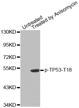 TP53 / p53 Antibody - Western blot analysis of extracts from MDA cells.