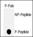 TP53 / p53 Antibody - Dot blot of anti-hp53-T18 Phospho-specific antibody on nitrocellulose membrane. 50ng of nonphospho-peptide or phospho-peptide were adsorbed on their respective dots. Antibody working concentration was 0.5ug per ml.