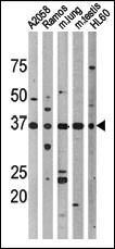 TP53 / p53 Antibody - Western blot of anti-Phospho-p53-T18 antibody in, from left to right, A2058, Ramos, mouse lung, mouse testis, and HL60 cell line lysates. Phospho-p53-T18(arrow) was detected using the purified antibody.