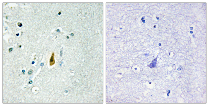 TP53 / p53 Antibody - Immunohistochemistry analysis of paraffin-embedded human brain, using p53 (Phospho-Thr81) Antibody. The picture on the right is blocked with the phospho peptide.