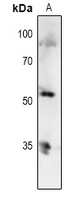 TP53 / p53 Antibody - Western blot analysis of p53 (pT81) expression in HCT116 (A) whole cell lysates.