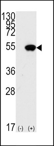 TP53 / p53 Antibody - Western blot of TP53(arrow) using rabbit polyclonal p53 Antibody (S15). 293 cell lysates (2 ug/lane) either nontransfected (Lane 1) or transiently transfected with the TP53 gene (Lane 2) (Origene Technologies).