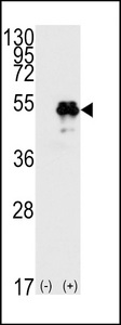 TP53 / p53 Antibody - Western blot of TP53(arrow) using rabbit polyclonal p53 Antibody (T55). 293 cell lysates (2 ug/lane) either nontransfected (Lane 1) or transiently transfected with the TP53 gene (Lane 2) (Origene Technologies).