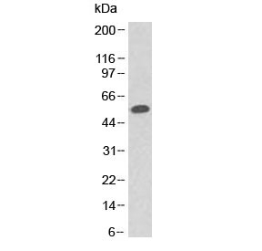 TP53 / p53 Mutant Antibody - Western blot testing of human A431 cell lysate with p53 antibody (clone Pab 1801). Expected molecular weight ~53 kDa.