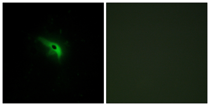 TP53AIP1 / p53 AIP1 Antibody - Immunofluorescence analysis of A549 cells, using TPIP1 Antibody. The picture on the right is blocked with the synthesized peptide.