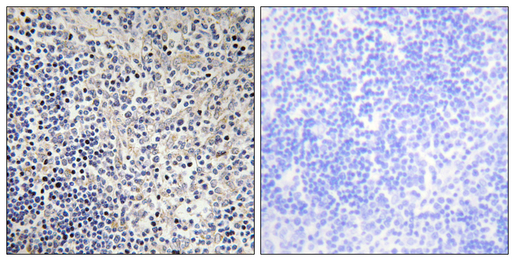 TP53AIP1 / p53 AIP1 Antibody - Immunohistochemistry analysis of paraffin-embedded human thymus gland tissue, using TPIP1 Antibody. The picture on the right is blocked with the synthesized peptide.