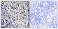 TP53AIP1 / p53 AIP1 Antibody - Immunohistochemistry analysis of paraffin-embedded human thymus gland tissue, using TPIP1 Antibody. The picture on the right is blocked with the synthesized peptide.