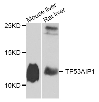 TP53AIP1 / p53 AIP1 Antibody - Western blot analysis of extracts of various cell lines.
