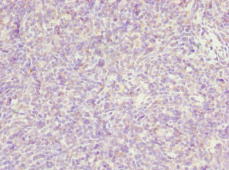 TP53AIP1 / p53 AIP1 Antibody - Immunohistochemistry of paraffin-embedded human thymus tissue at dilution 1:100