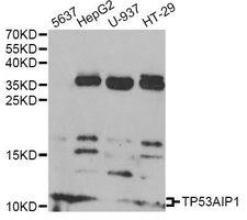 TP53AIP1 / p53 AIP1 Antibody - Western blot analysis of extracts of various cell lines, using TP53AIP1 antibody at 1:1000 dilution. The secondary antibody used was an HRP Goat Anti-Rabbit IgG (H+L) at 1:10000 dilution. Lysates were loaded 25ug per lane and 3% nonfat dry milk in TBST was used for blocking. An ECL Kit was used for detection and the exposure time was 90s.