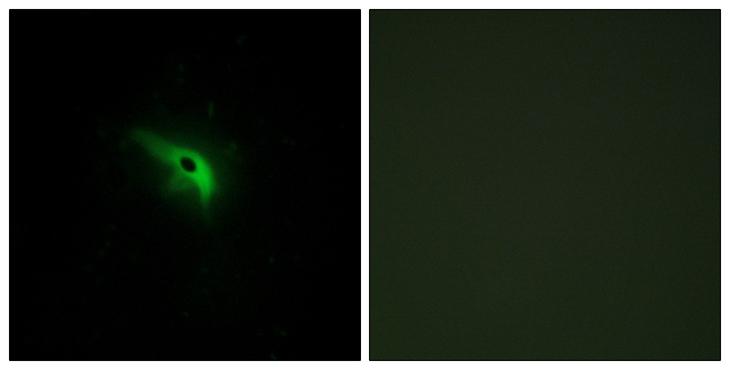 TP53AIP1 / p53 AIP1 Antibody - Peptide - + Immunofluorescence analysis of A549 cells, using TPIP1 antibody.