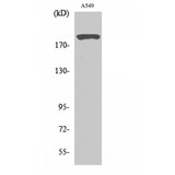 TP53BP1 / 53BP1 Antibody - Western blot of 53BP1 antibody