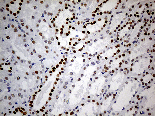 TP53BP1 / 53BP1 Antibody - Immunohistochemical staining of paraffin-embedded Human Kidney tissue within the normal limits using anti-TP53BP1 mouse monoclonal antibody. (Heat-induced epitope retrieval by 1mM EDTA in 10mM Tris buffer. (pH8.5) at 120°C for 3 min. (1:500)