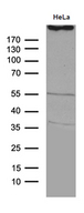 TP53BP1 / 53BP1 Antibody - Western blot analysis of extracts. (35ug) from HELA cell line by using anti-TP53BP1 monoclonal antibody. (1:500)