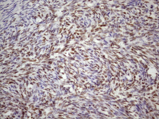 TP53BP1 / 53BP1 Antibody - Immunohistochemical staining of paraffin-embedded Human Ovary tissue within the normal limits using anti-TP53BP1 mouse monoclonal antibody. (Heat-induced epitope retrieval by 1 mM EDTA in 10mM Tris, pH8.5, 120C for 3min. (1:150)