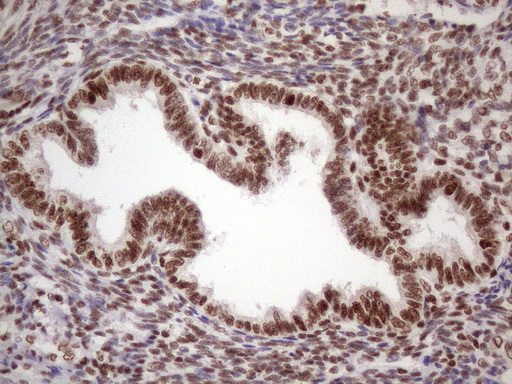 TP53BP1 / 53BP1 Antibody - Immunohistochemical staining of paraffin-embedded Human endometrium tissue within the normal limits using anti-TP53BP1 mouse monoclonal antibody. (Heat-induced epitope retrieval by 1 mM EDTA in 10mM Tris, pH8.5, 120C for 3min. (1:150)