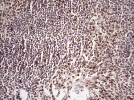 TP53BP1 / 53BP1 Antibody - Immunohistochemical staining of paraffin-embedded Human tonsil within the normal limits using anti-TP53BP1 mouse monoclonal antibody. (Heat-induced epitope retrieval by 1 mM EDTA in 10mM Tris, pH8.5, 120C for 3min. (1:150)