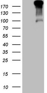 TP53BP1 / 53BP1 Antibody - HEK293T cells were transfected with the pCMV6-ENTRY control (Left lane) or pCMV6-ENTRY TP53BP1 (Right lane) cDNA for 48 hrs and lysed. Equivalent amounts of cell lysates (5 ug per lane) were separated by SDS-PAGE and immunoblotted with anti-TP53BP1 (1:2000).
