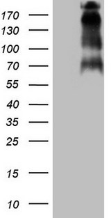 TP53BP1 / 53BP1 Antibody - HEK293T cells were transfected with the pCMV6-ENTRY control. (Left lane) or pCMV6-ENTRY. (Right lane) cDNA for 48 hrs and lysed. Equivalent amounts of cell lysates. (5 ug per lane) were separated by SDS-PAGE and immunoblotted with anti-TP53BP1. (1:2000)