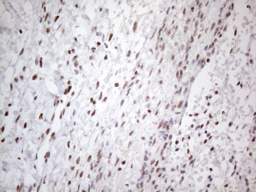 TP53BP1 / 53BP1 Antibody - Immunohistochemical staining of paraffin-embedded Human Ovary tissue within the normal limits using anti-TP53BP1 mouse monoclonal antibody. (Heat-induced epitope retrieval by 1mM EDTA in 10mM Tris buffer. (pH8.5) at 120°C for 3 min. (1:150)