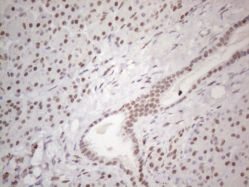 TP53BP1 / 53BP1 Antibody - Immunohistochemical staining of paraffin-embedded Human pancreas tissue within the normal limits using anti-TP53BP1 mouse monoclonal antibody. (Heat-induced epitope retrieval by 1mM EDTA in 10mM Tris buffer. (pH8.5) at 120°C for 3 min. (1:150)