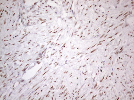 TP53BP1 / 53BP1 Antibody - Immunohistochemical staining of paraffin-embedded Human endometrium tissue within the normal limits using anti-TP53BP1 mouse monoclonal antibody. (Heat-induced epitope retrieval by 1mM EDTA in 10mM Tris buffer. (pH8.5) at 120°C for 3 min. (1:150)