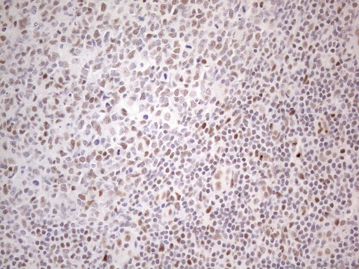 TP53BP1 / 53BP1 Antibody - Immunohistochemical staining of paraffin-embedded Human tonsil within the normal limits using anti-TP53BP1 mouse monoclonal antibody. (Heat-induced epitope retrieval by 1mM EDTA in 10mM Tris buffer. (pH8.5) at 120°C for 3 min. (1:150)