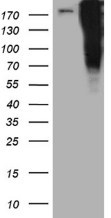 TP53BP1 / 53BP1 Antibody - HEK293T cells were transfected with the pCMV6-ENTRY control. (Left lane) or pCMV6-ENTRY. (Right lane) cDNA for 48 hrs and lysed. Equivalent amounts of cell lysates. (5 ug per lane) were separated by SDS-PAGE and immunoblotted with anti-TP53BP1. (1:2000)