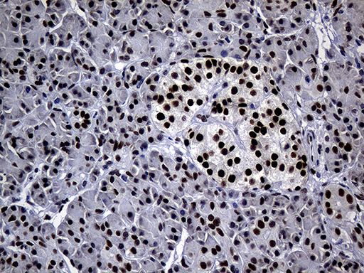 TP53BP1 / 53BP1 Antibody - Immunohistochemical staining of paraffin-embedded Human pancreas tissue within the normal limits using anti-TP53BP1 mouse monoclonal antibody. (Heat-induced epitope retrieval by 1mM EDTA in 10mM Tris buffer. (pH8.5) at 120°C for 3 min. (1:2000)