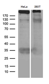 TP53BP1 / 53BP1 Antibody - Western blot analysis of extracts. (35ug) from 2 different cell lines by using anti-TP53BP1 monoclonal antibody. (1:500)