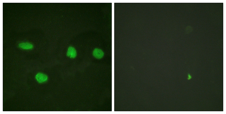 TP53BP1 / 53BP1 Antibody - Immunofluorescence analysis of HeLa cells, using 53BP1 Antibody. The picture on the right is blocked with the synthesized peptide.