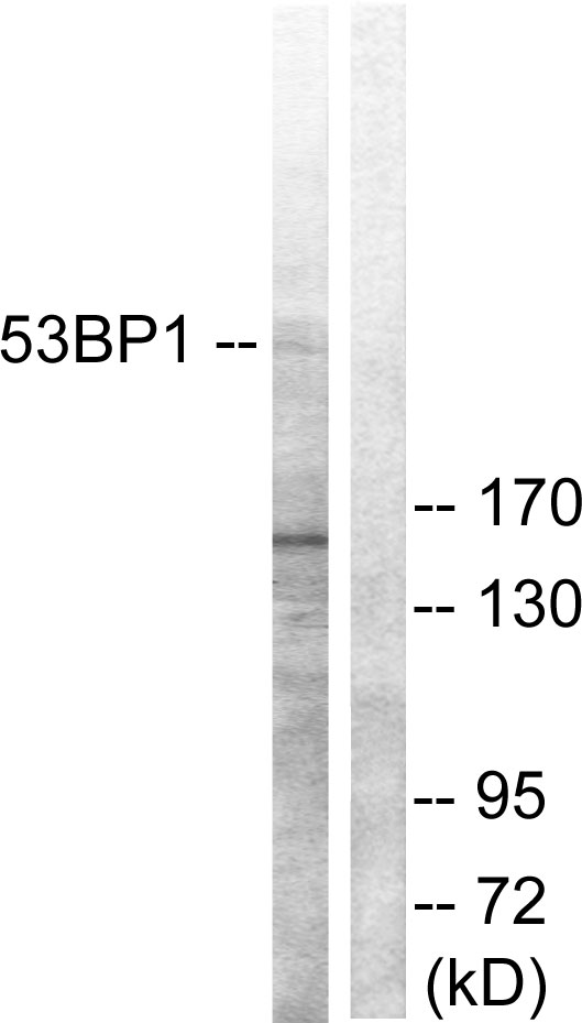 TP53BP1 / 53BP1 Antibody - Western blot analysis of lysates from A549 cells, using 53BP1 Antibody. The lane on the right is blocked with the synthesized peptide.