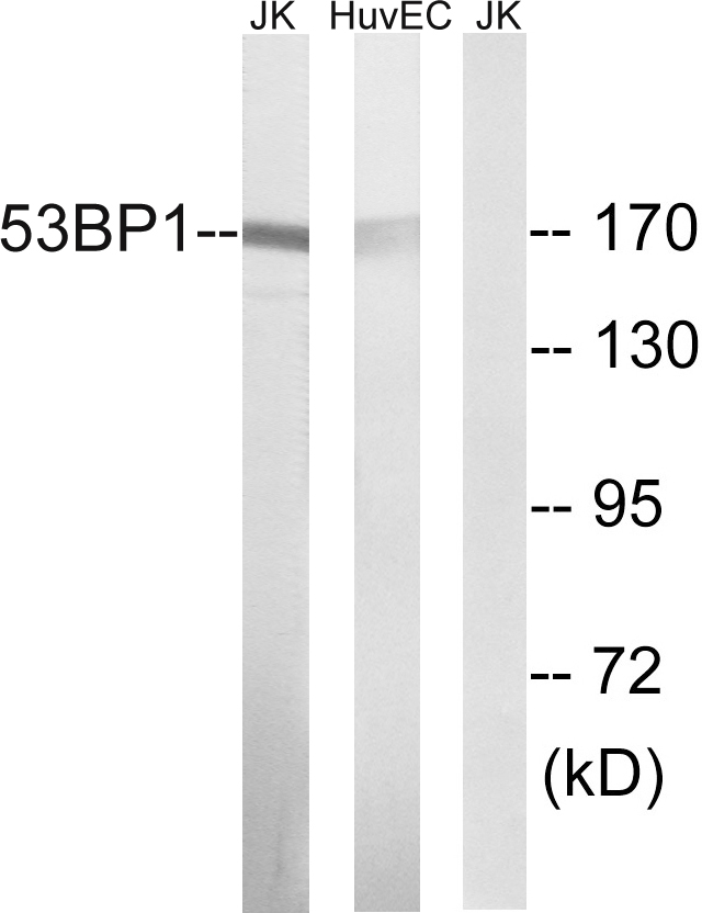 TP53BP1 / 53BP1 Antibody - Western blot analysis of lysates from Jurkat and HUVEC cells, using 53BP1 Antibody. The lane on the right is blocked with the synthesized peptide.