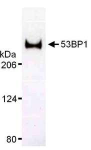 TP53BP1 / 53BP1 Antibody - Detection of Human [deleted mouse] 53BP1 by Western Blot Sample: Whole cell lysate (20 ug/lane) from U2OS cells resolved on a 3 to 8% Tris-acetate gel. Antibody: Affinity purified rabbit anti-53BP1 used at 0.17 ug/ml. Detection: Chemiluminescence with a 15 second exposure.