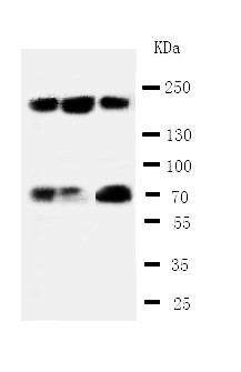 TP53BP1 / 53BP1 Antibody - WB of TP53BP1 / 53BP1 antibody. Lane 1: 293T Cell Lysate. Lane 2: U20S Cell Lysate. Lane 3: HEPA Cell Lysate.