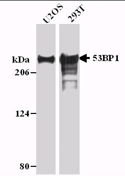 TP53BP1 / 53BP1 Antibody - Detection of 53BP1 in U2OS and 293T cell lysates (20 ug/lane). ECL with a 5 second exposure.  This image was taken for the unconjugated form of this product. Other forms have not been tested.