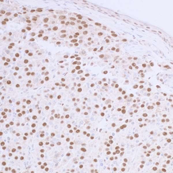 TP53BP1 / 53BP1 Antibody - Detection of Mouse 53BP1 by Immunohistochemistry. Sample: FFPE sections of mouse renal cell carcinoma. Antibody: Affinity purified rabbit anti-53BP1 used at a dilution of 1:1,000 (1µg/ml). Detection: DAB.