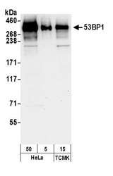 TP53BP1 / 53BP1 Antibody - Detection of human and mouse 53BP1 by western blot. Samples: Nuclear extract (50 and 5 µg) from HeLa and (15 µg) from mouse TCMK-1 cells. Antibody: Affinity purified rabbit anti-53BP1 antibody used for WB at 0.04 µg/ml. Detection: Chemiluminescence with an exposure time of 30 seconds.